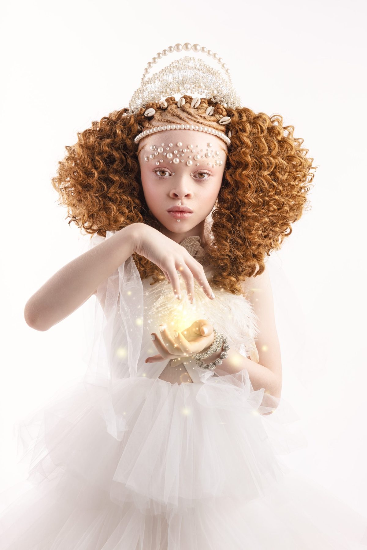 Child with albinism photographed for albinism awareness